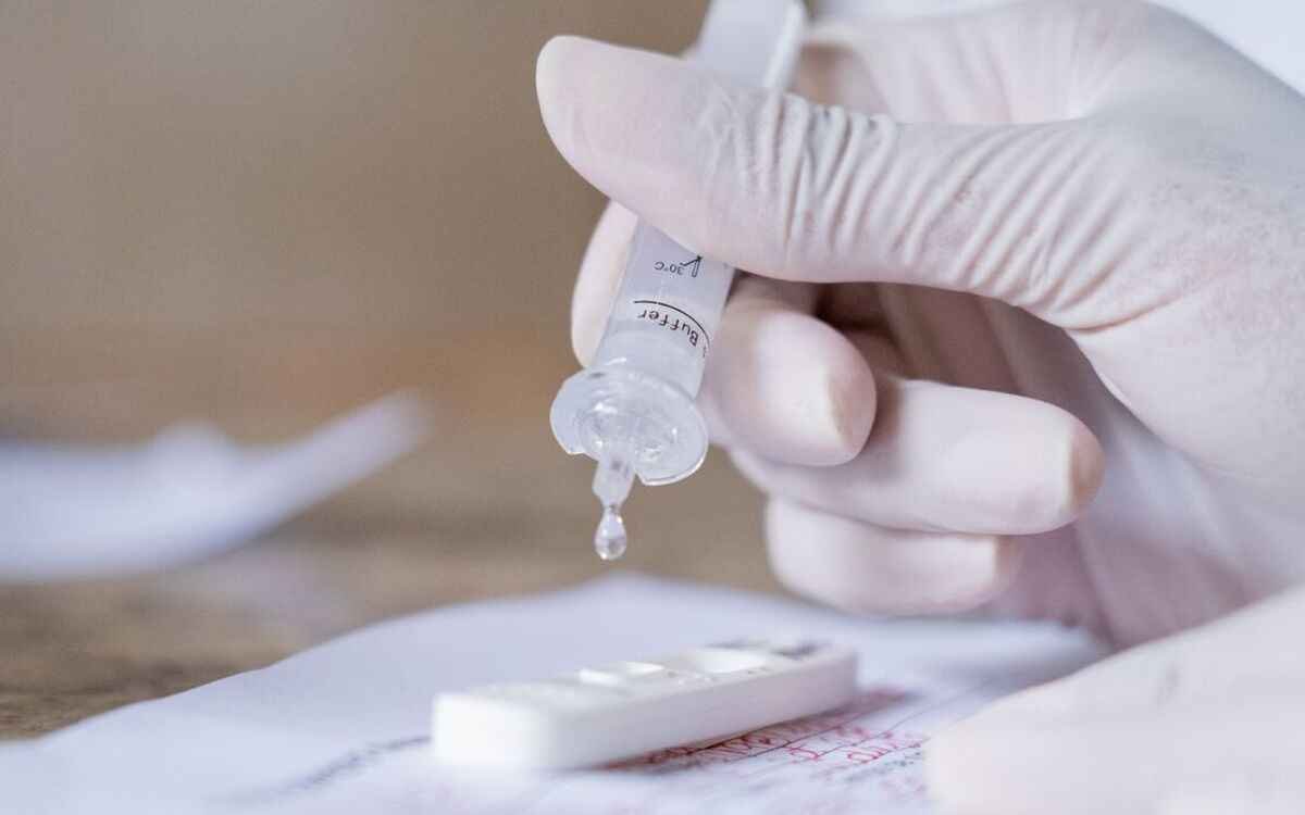 COVID: testes rápidos estão incluídos nos planos de saúde - Myke Sena/MS
