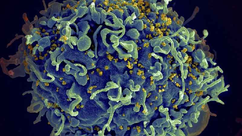 Variante do HIV mais transmissível e agressiva é encontrada na Holanda - Getty Images