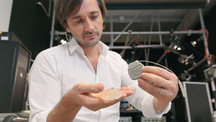 O implante que fez três paraplégicos voltarem a andar; entenda como funciona - Prensa Libre, AFP