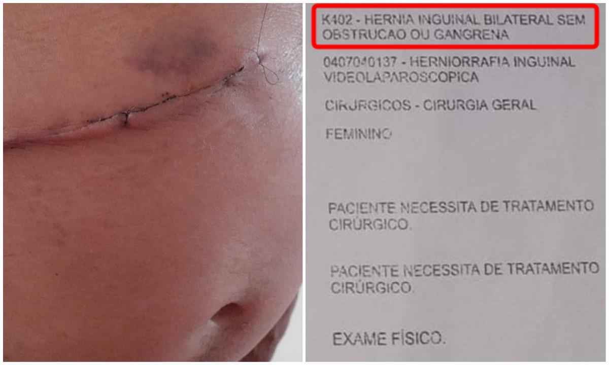 Homem espera 11 anos para retirar hérnia e sai de hospital sem vesícula - Assis Fernandes/Arquivo pessoal