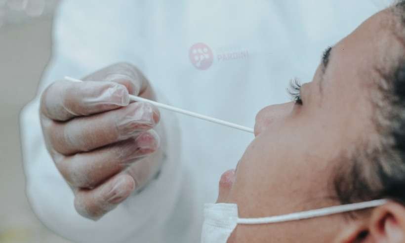 Cai volume semanal de pacientes de casos positivos para COVID-19 em Minas - Grupo Pardini/Divulgação