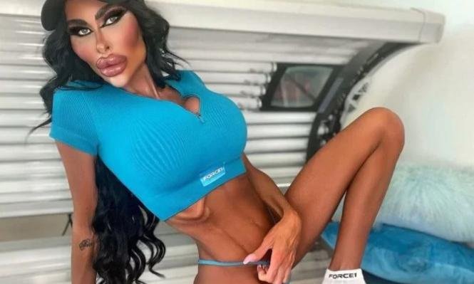 'Barbie Humana' já gastou R$ 1 milhão com cirurgias plásticas - Reprodução