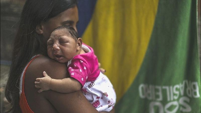 Mãe segura bebê com microcefalia -  (crédito: EPA)