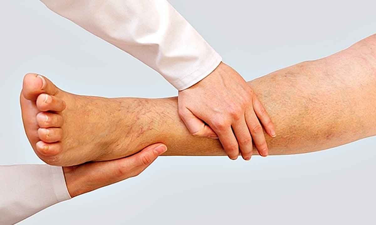 Sente dor nas pernas? Incômodo pode ir além de problemas circulatórios - Ltra Comunicação e Marketing/Divulgação