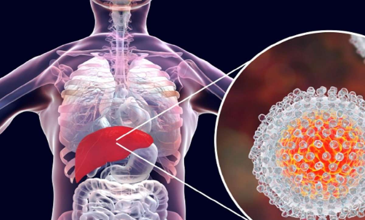 Minas confirma quatro casos de hepatite aguda grave em crianças  - Reprodução/Internet