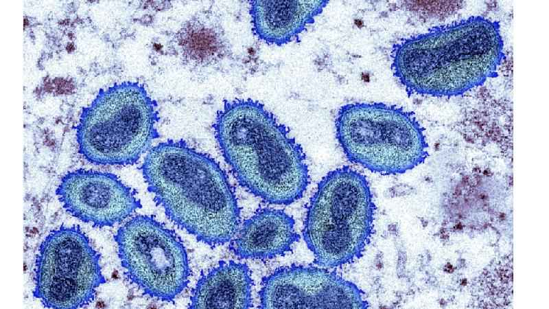 Varíola dos macacos: o que se sabe sobre a mortalidade da doença - SCIENCE PHOTO LIBRARY