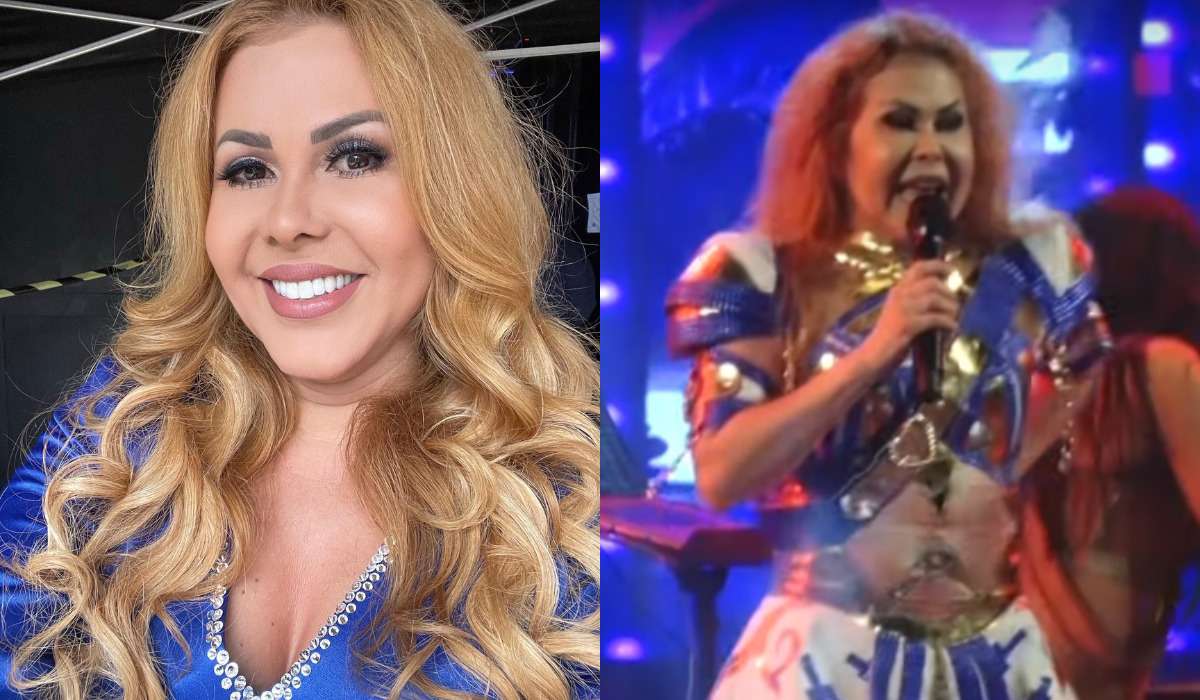 Rosto inchado de Joelma desperta preocupação com o pós-COVID - Reprodução Rede Social