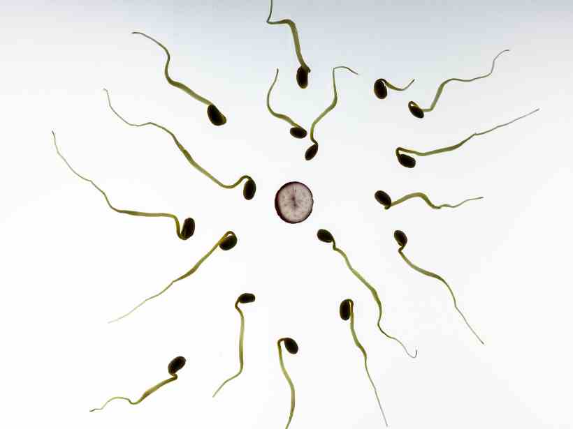 Alerta: varicocele é a principal causa de infertilidade masculina  - Thomas Breher/Pixabay