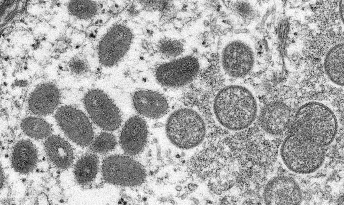 Minas investiga o 1º caso suspeito de varíola dos macacos, em Uberlândia - Reprodução/Agência Brasil/Cynthia S. Goldsmith