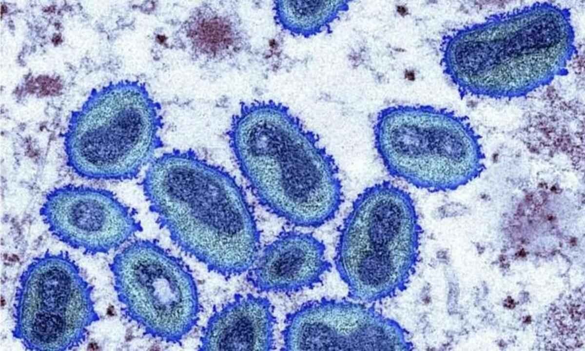 Minas investiga 3 suspeitas de varíola dos macacos; 6 casos são descartados - Science Photo Library