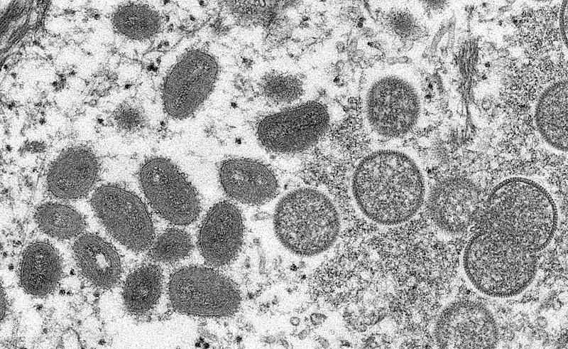 Varíola do macaco: Ministério da Saúde confirma 2º caso suspeito no DF - AFP