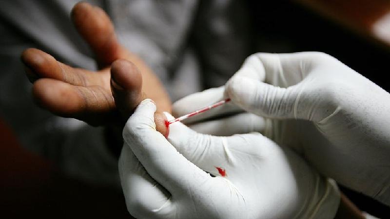 O que torna a população negra mais vulnerável ao HIV e a morrer por complicações da Aids - Brent Stirton/Getty Images