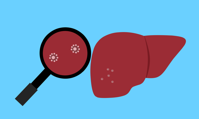 Julho Amarelo é o mês da luta contra as hepatites virais - Mohamed Hassan/Pixabay 