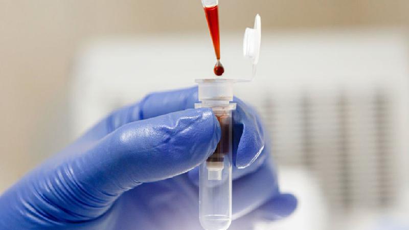 Biópsia líquida: exame de sangue permite acompanhar evolução do câncer - Future Publishing/Getty Images
