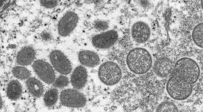 Varíola dos Macacos: Minas chega a 23 contaminados - Reprodução