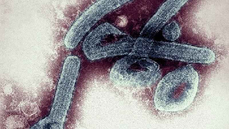 O que é o vírus Marburg, 'primo' do ebola que voltou a preocupar  - Getty Images