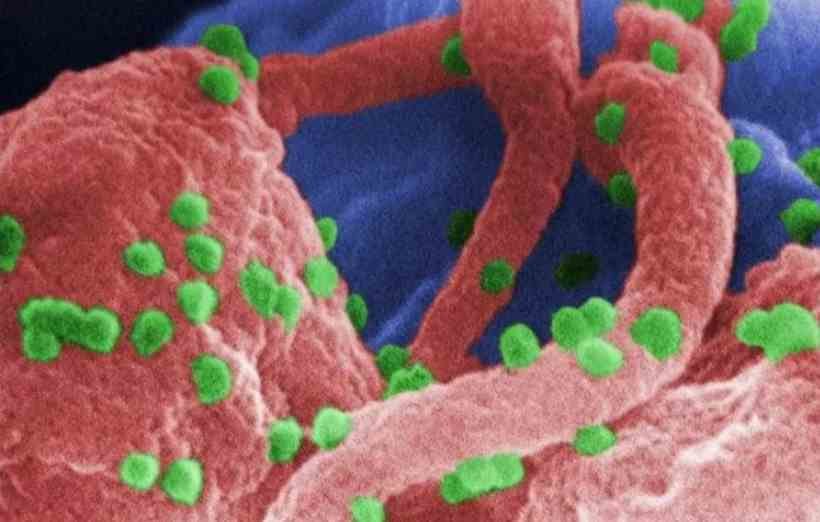Transplante de células-tronco para tratar leucemia cura paciente com HIV - C. Goldsmith, P. Feorino, E. L. Palmer, W. R. McManus, CDC/Divulgação