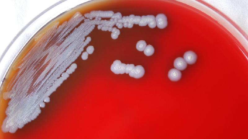 Perigosa bactéria achada no Mississipi (EUA) deixa autoridades em alerta - Getty Images