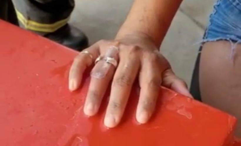 Jovem com dedo estrangulado por anel é socorrida por bombeiros -  CBMMG