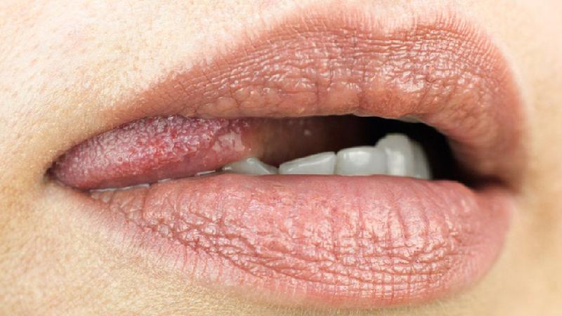 Sexo oral sem preservativo pode provocar doenças: entenda riscos e como se proteger - Getty Images