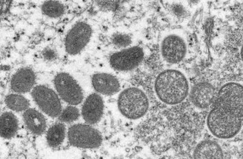 Diretrizes ainda fracas dificultam tratamento da varíola dos macacos - Cynthia S. Goldsmith