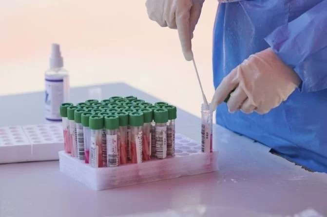 Anvisa libera uso de vacina e medicamento contra varíola dos macacos - AFP