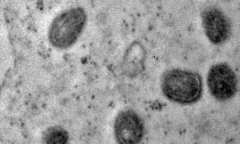 Fiocruz registra imagens de replicação do vírus monkeypox em célula - Débora F. BArreto-Vieira/IOC/Fiocruz