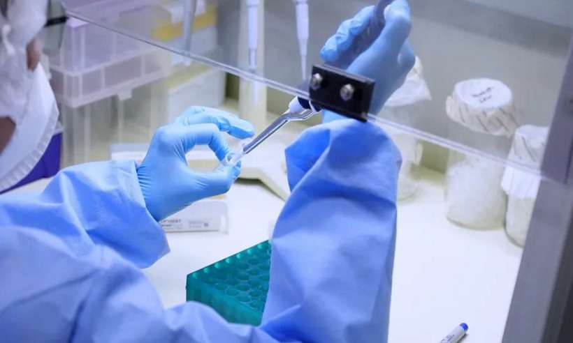 Testagem para varíola dos macacos ainda é limitada no Brasil - Josué Damacena/IOC/Fiocruz