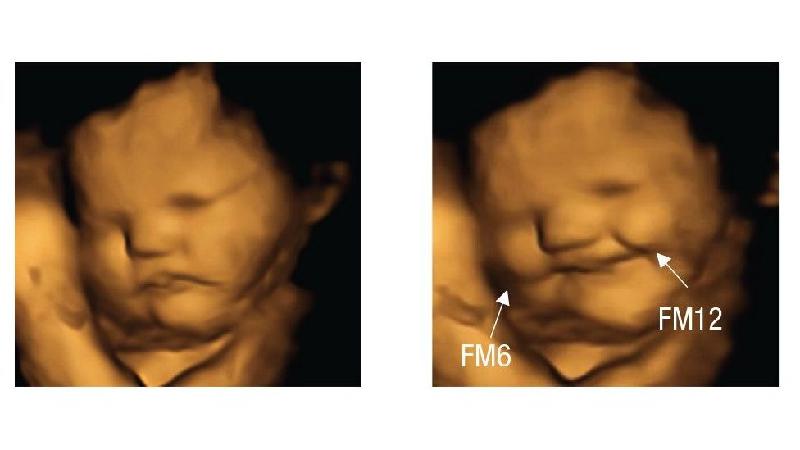 Bebês no útero 'sorriem' para cenouras e 'fazem careta' para couve, dizem cientistas - Divulgação