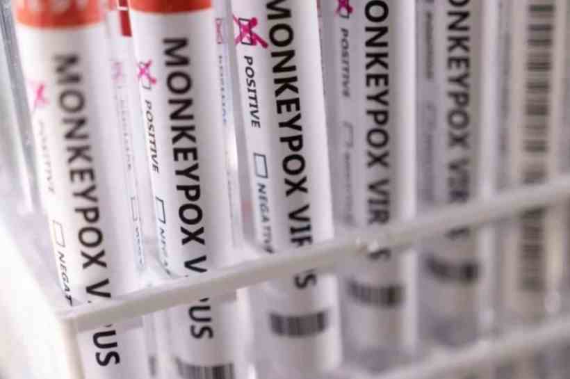 Saúde cadastra laboratórios para diagnóstico de varíola dos macacos - Reprodução