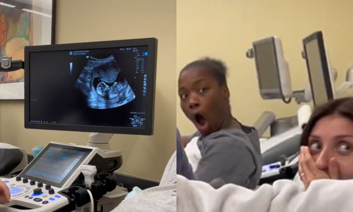 Garota finge descoberta de gravidez durante aula de ultrassom e viraliza  - Reprodução Redes Sociais 