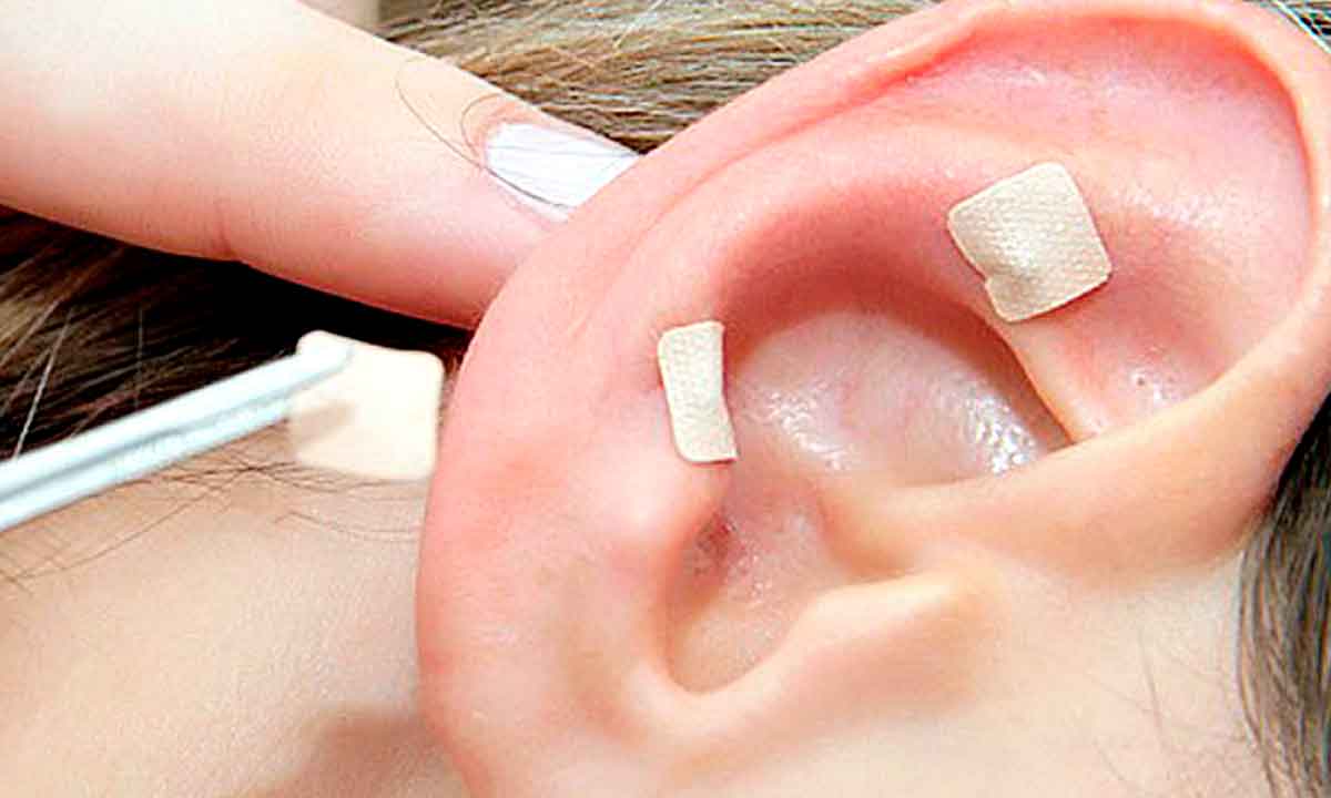  Conheça os benefícios da auriculoterapia para tratar as alergias - Reprodução