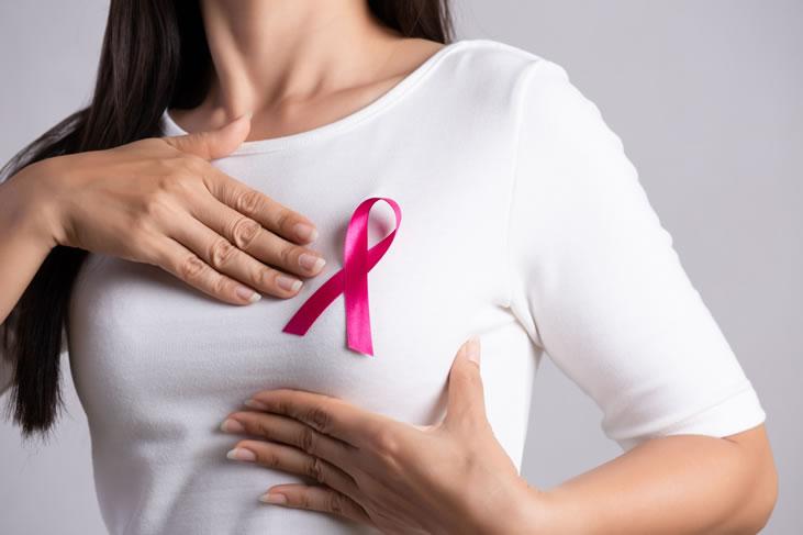 Sábado (22) será o Dia D do combate ao câncer de mama em cidades da RMBH - Shutterstock