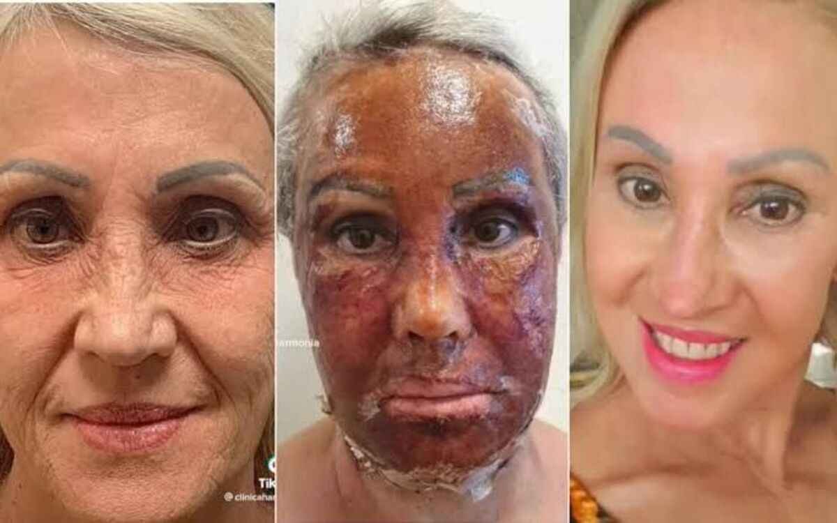 Viralizou nas redes: entenda a técnica que fez mulher 'trocar de pele' - TikTok/Divulgação