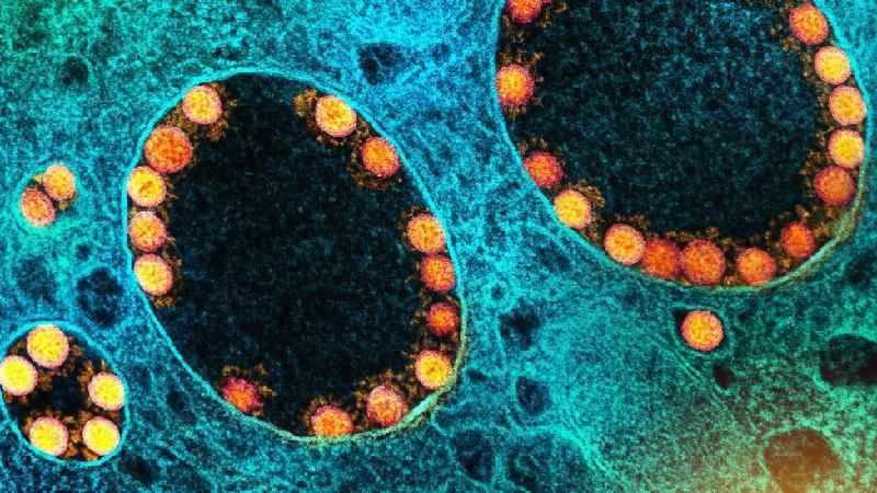 BQ.1: o que se sabe sobre variante da ômicron descoberta no Brasil - NIAD-National Institute of Allergy and Infectious