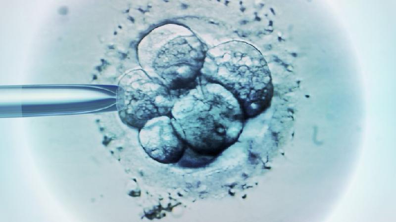 Inseminação intrauterina, fertilização in vitro: qual método é mais eficaz e o que está disponível no SUS?