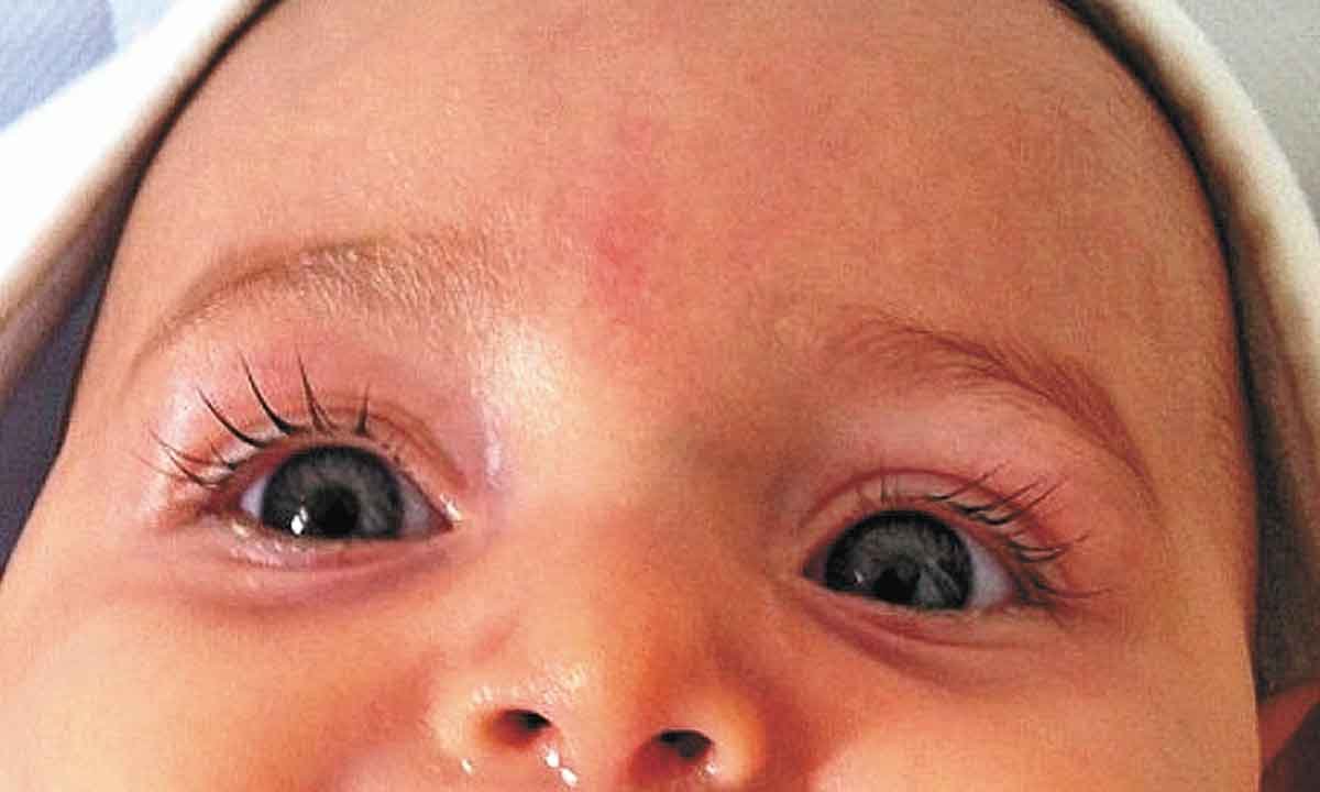 Cartilha sobre saúde ocular na infância orienta pais e professores