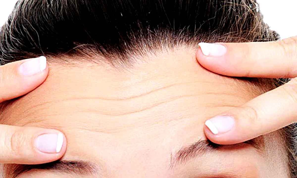 O tamanho da sua testa incomoda? Frontoplastia pode ser a solução - INTERNET/REPRODUÇÃO
