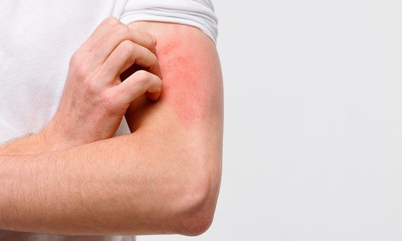 Janeiro Roxo: campanha alerta sobre o tratamento precoce da hanseníase - Freepik/Divulgação