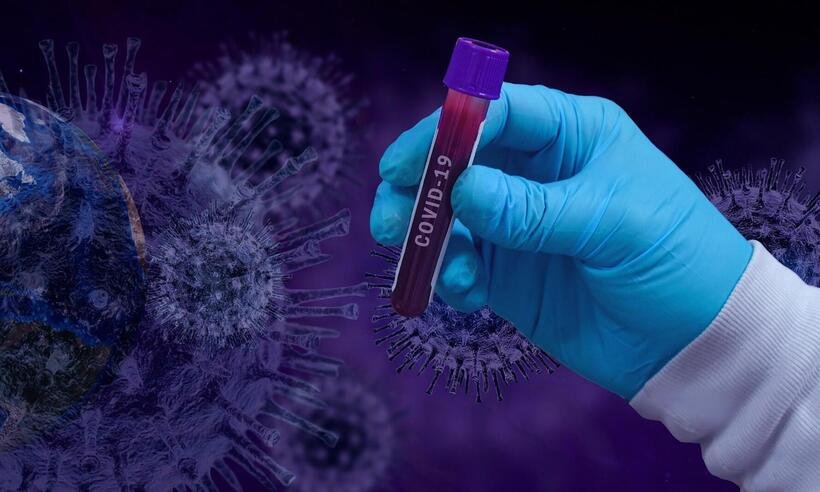 Cientistas brasileiros identificam antiviral para tratamento da COVID - fernando zhiminaicela/Pixabay 