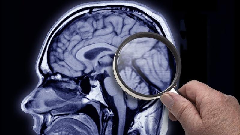 Cientistas descobrem uma nova estrutura no cérebro humano - Getty Images