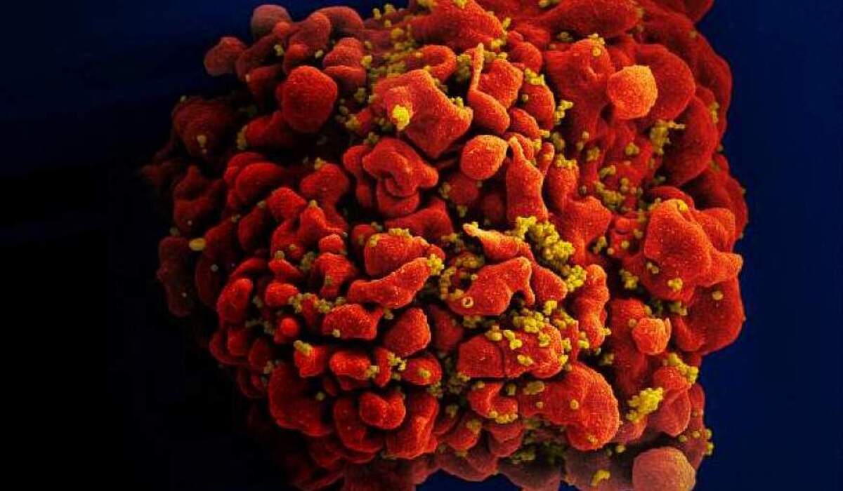 Estudo para vacina contra Aids é descontinuado por ineficácia - AFP PHOTO/National Institutes of Health
