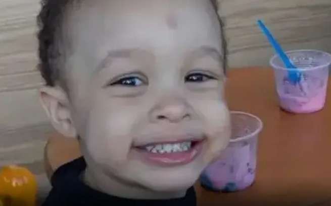Menino Ian Henrique Almeida Cunha, de 2 anos -  (crédito: Reprodu&ccedil;&atilde;o / Redes Sociais)