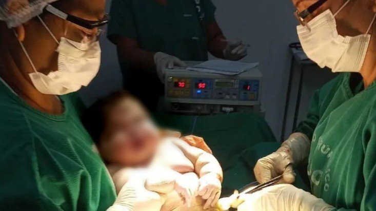 Bebê de 7,3kg no Amazonas: quais os riscos de dar à luz um filho 'gigante' - SES-AM/Divulgação 