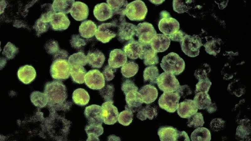 Infecção rara por ameba comedora de cérebro mata homem - Getty Images