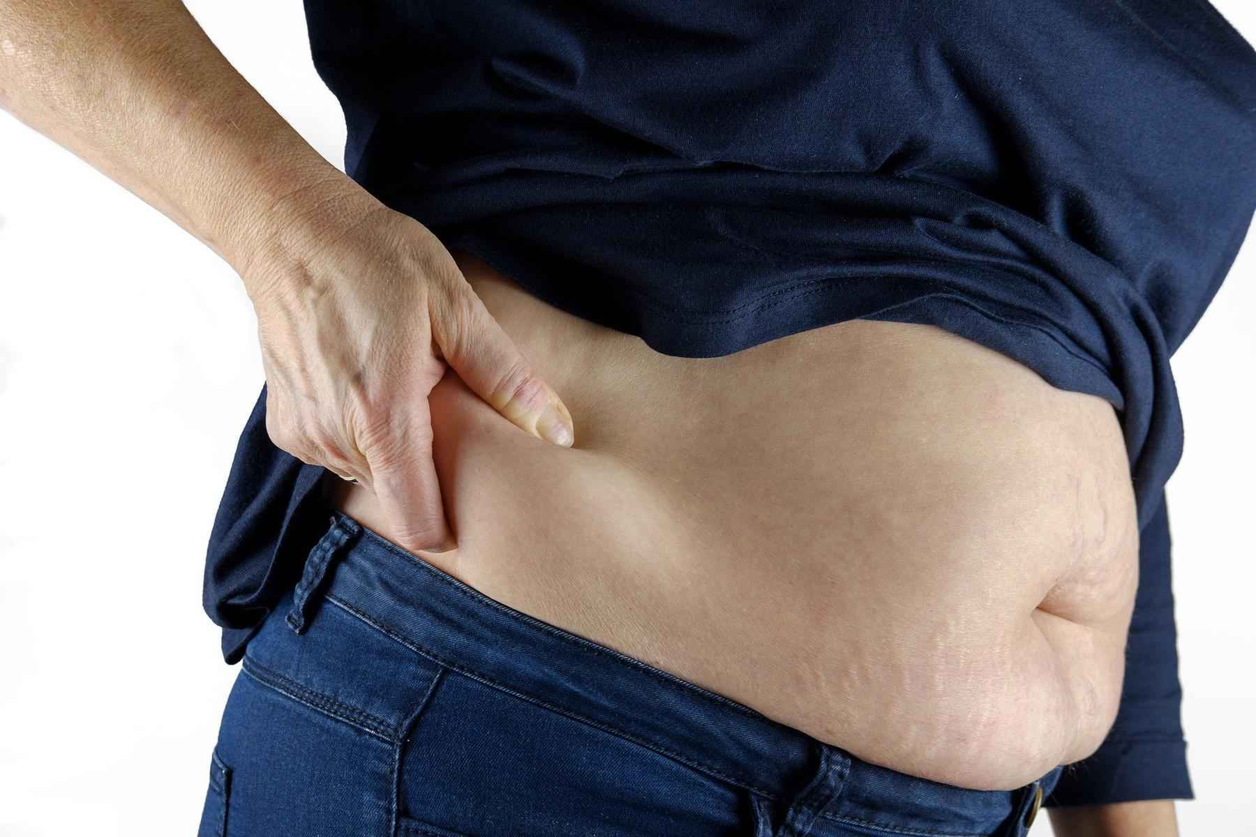 Silenciosas, doenças renais crônicas estão associadas à obesidade - Pixabay