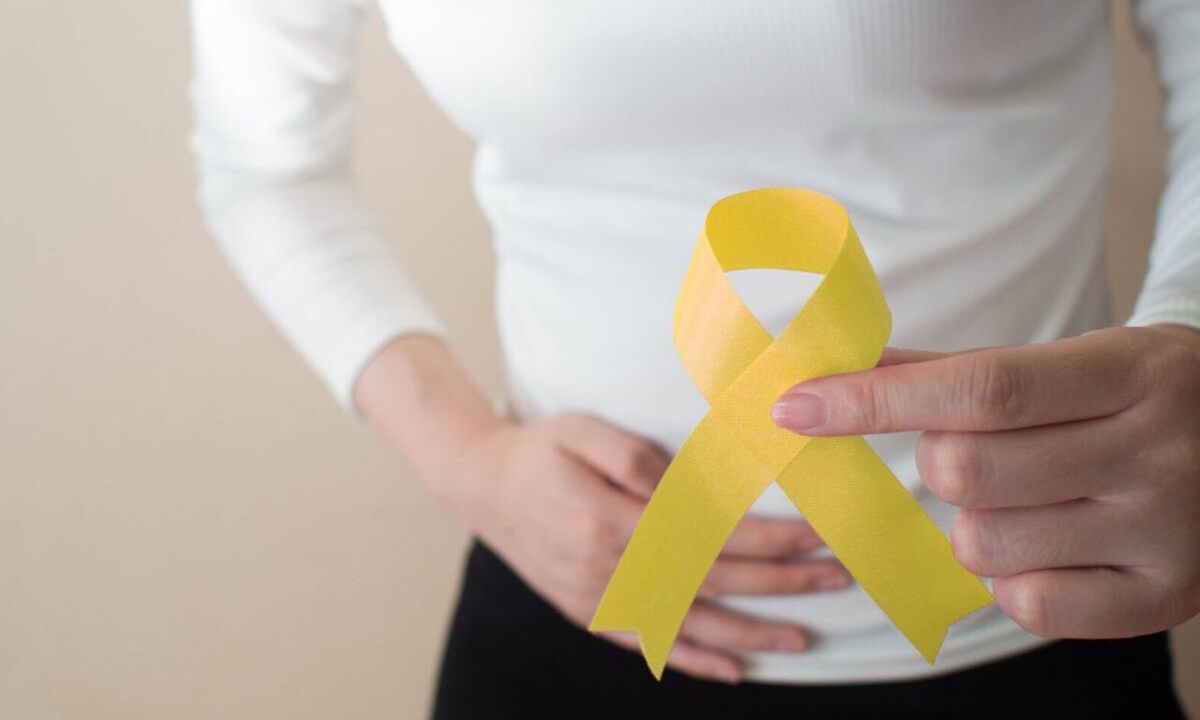 Campanha Março Amarelo informa como tratar a dolorosa endometriose - CEU/reprodução 