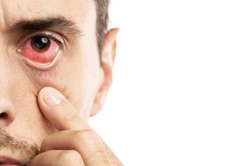 Olho seco no outono: saiba como aliviar os sintomas sem prejudicar a visão