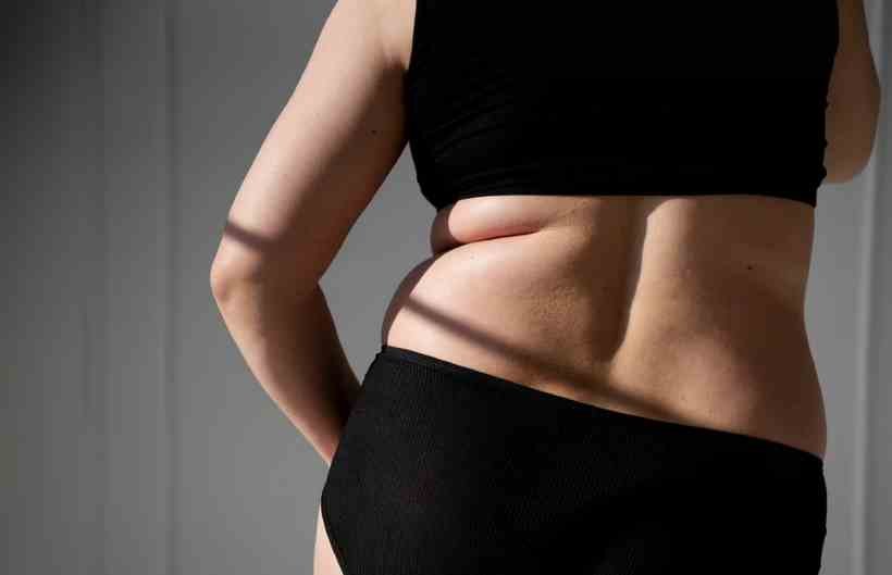 Abaixo a magreza excessiva: biotipo não é tendência - Freepik