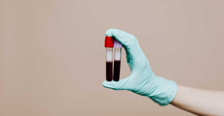 Exames identificam fatores de coagulação sanguínea para tratar hemofilia - Pexels